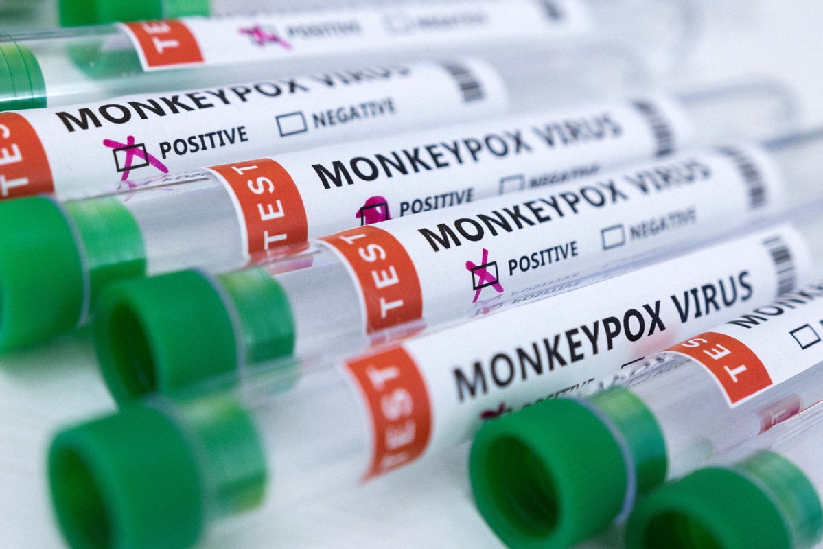Trung Quốc cấp phép lưu hành bộ xét nghiệm virus đậu mùa khỉ đầu tiên -0