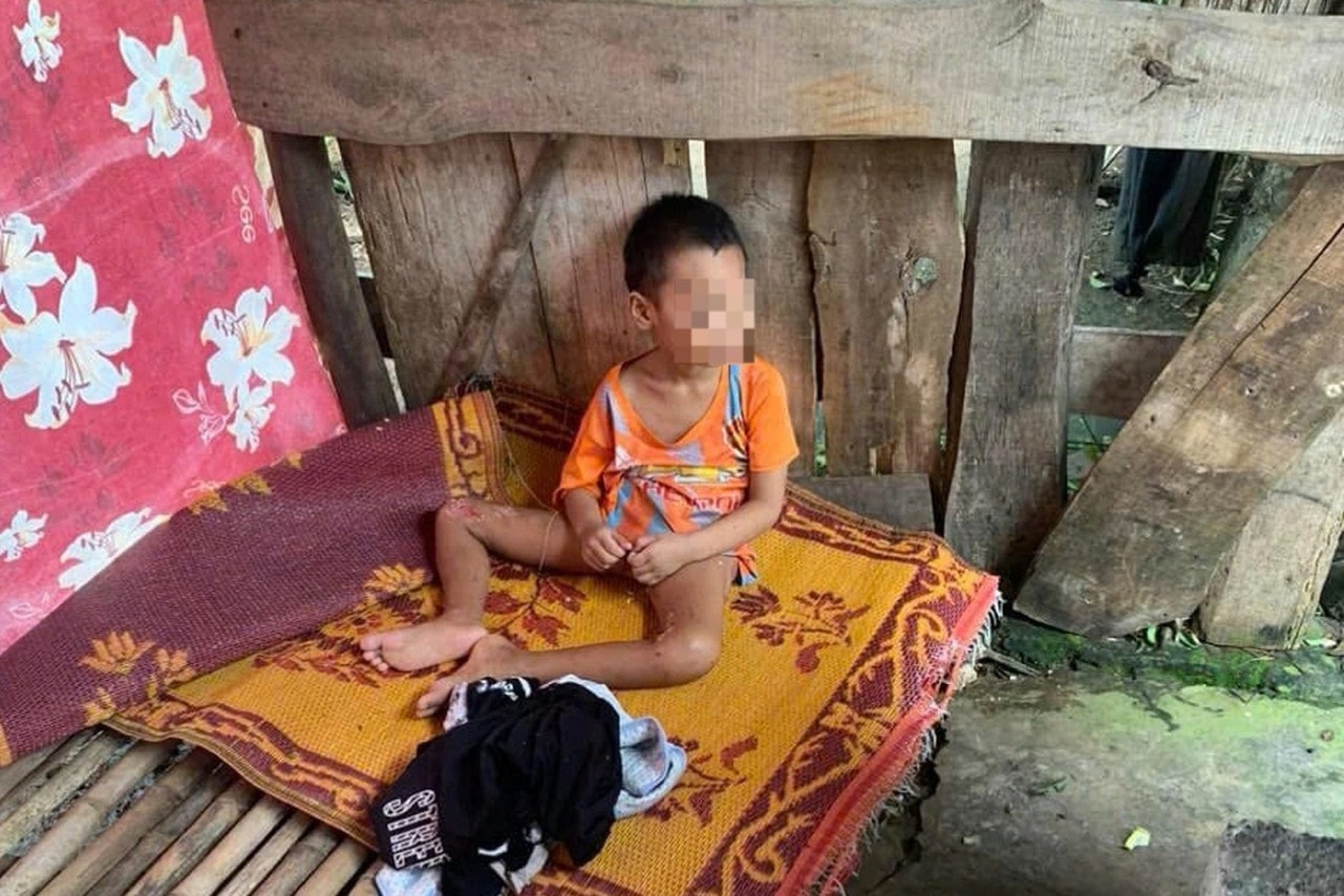 Nghệ An: Phát hiện bé trai tội nghiệp với nhiều vết thương trong căn lều tạm -0