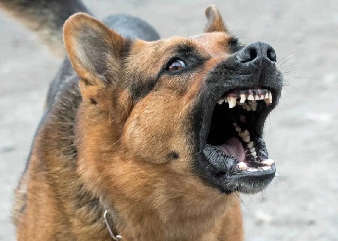 Bị chó hàng xóm tấn công, người đàn ông mất toàn bộ cánh mũi phải -0