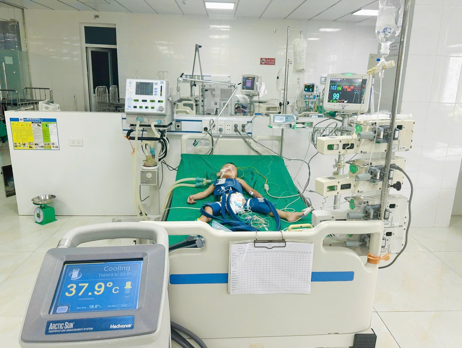 Cứu sống thành công hai trẻ ngừng tim, ngừng thở do đuối nước -0