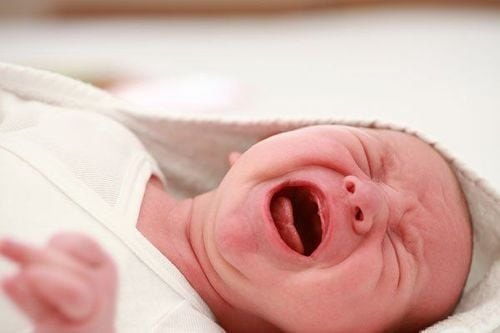 Phẫu thuật thành công dị tật đường tiêu hoá cho trẻ sơ sinh người Lào -0