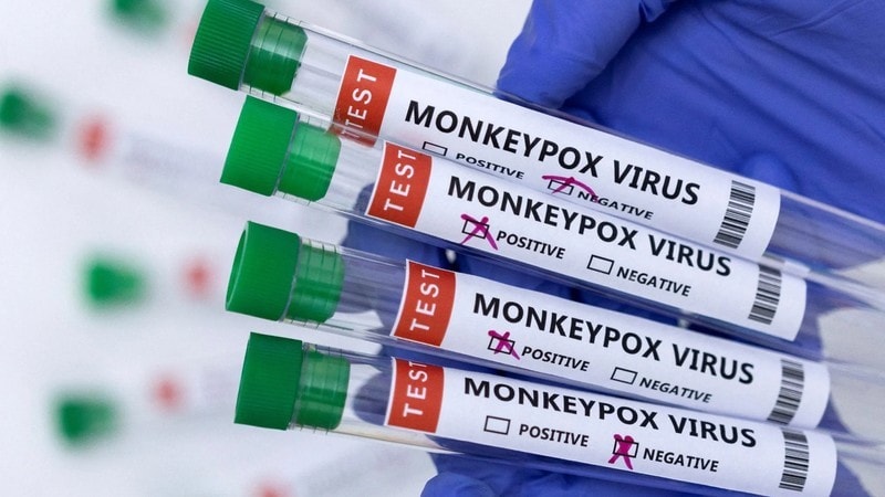 The-Department-of-Health-says-it-is-in-the-process-of-securing-vaccine-for-mpox-Picture-Dado-Ruvic-Illustration-File-Photo-Reuters.jpeg