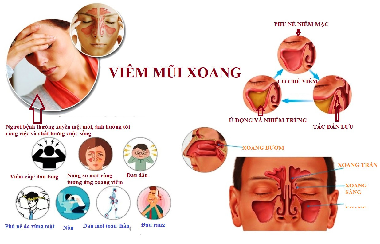 thoi-quen-vmx-4241-5319.png
