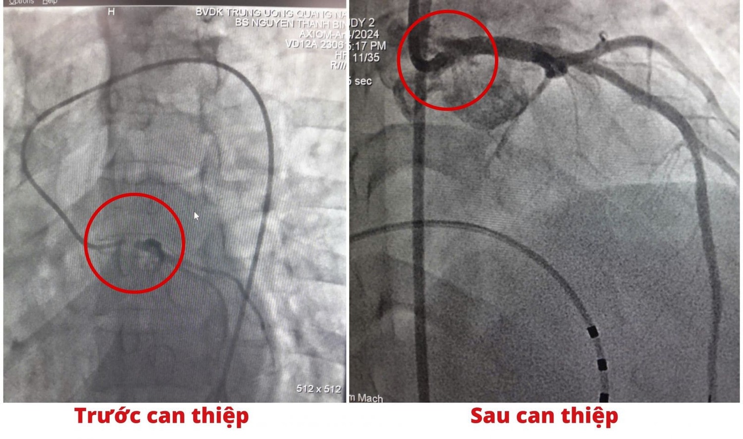 hinh-1-0a03e.jpg