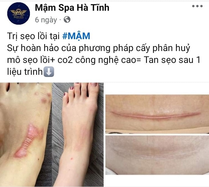 anh-9.jpg