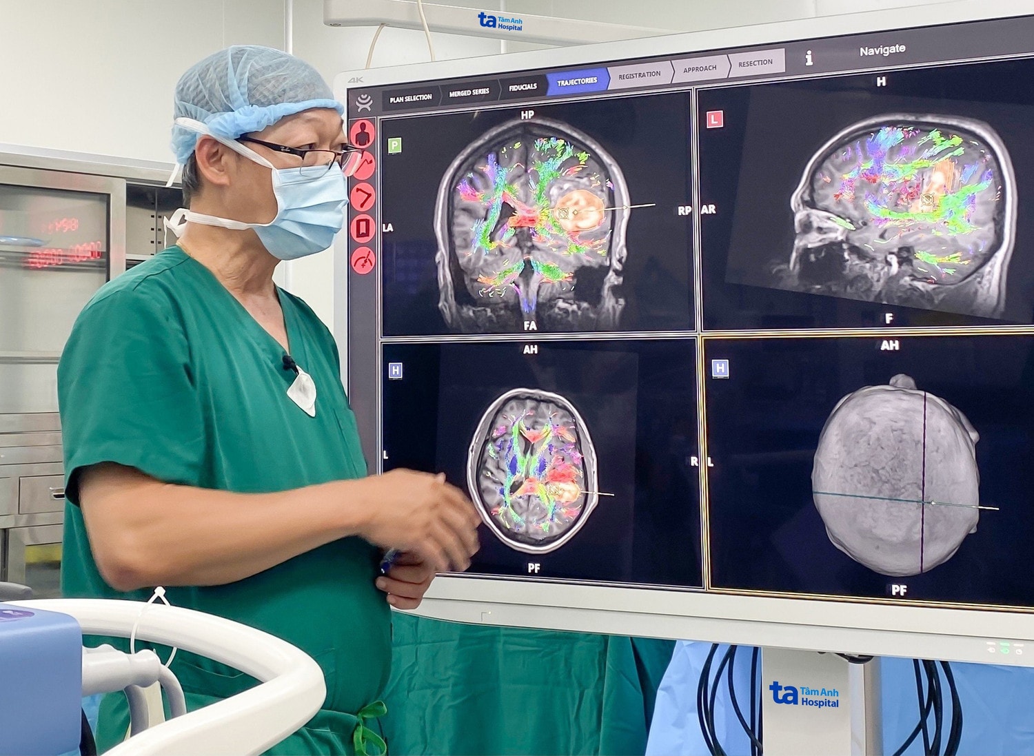 nho-cong-nghe-ai-tich-hop-trong-robot-modus-v-synaptive-bac-si-chu-tan-si-co-the-phan-tich-cac-bo-soi-than-kinh-quyet-dinh-duong-mo-an-toan-truoc-khi-phau-thuat-anh-benh-vien-da-khoa-tam-anh-tphcmjpg.jpg
