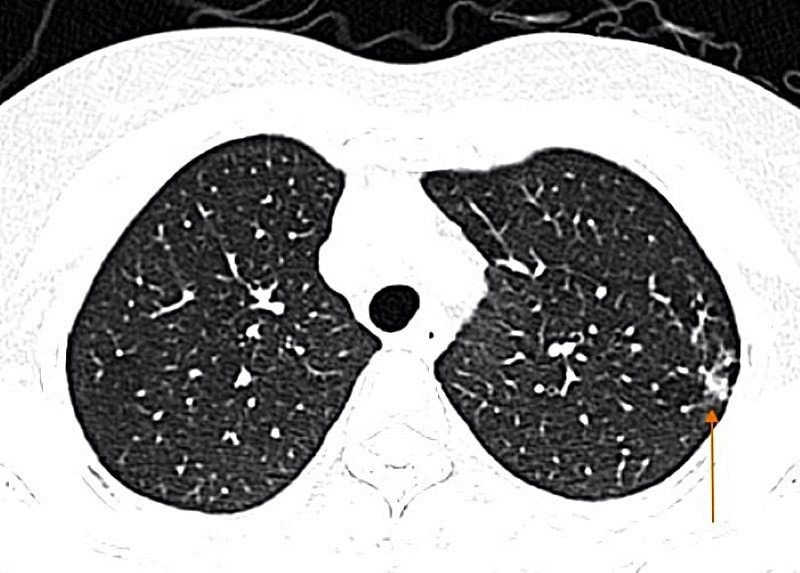 xet-nghiem-cum-medlatec-1.jpg