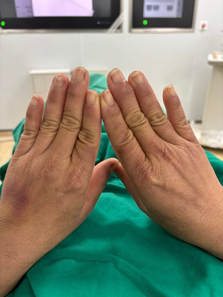raynaud-1-768x1024.jpg