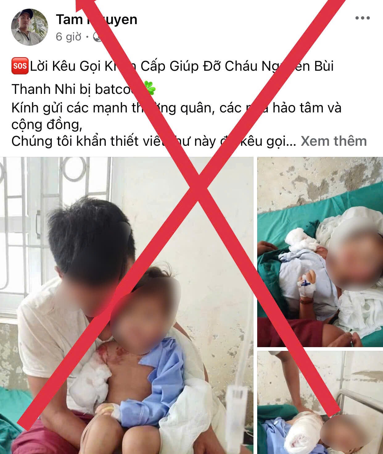 anh 9