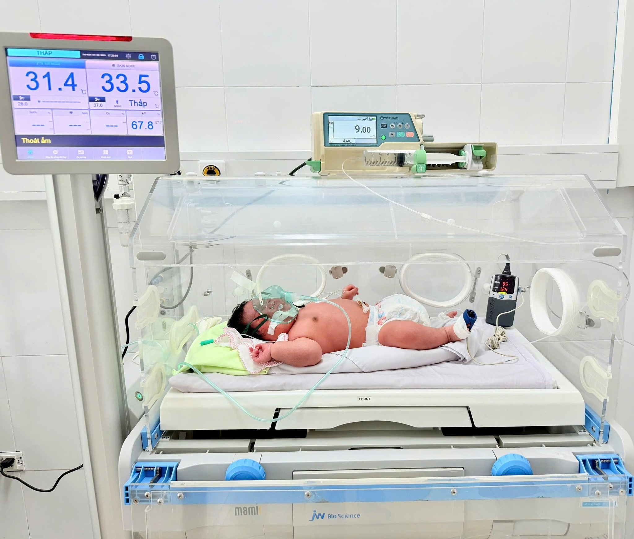 Bé trai chào đời nặng 6,2kg tại Bệnh viện Đa khoa Khu vực Cẩm Phả. Ảnh: BVCC