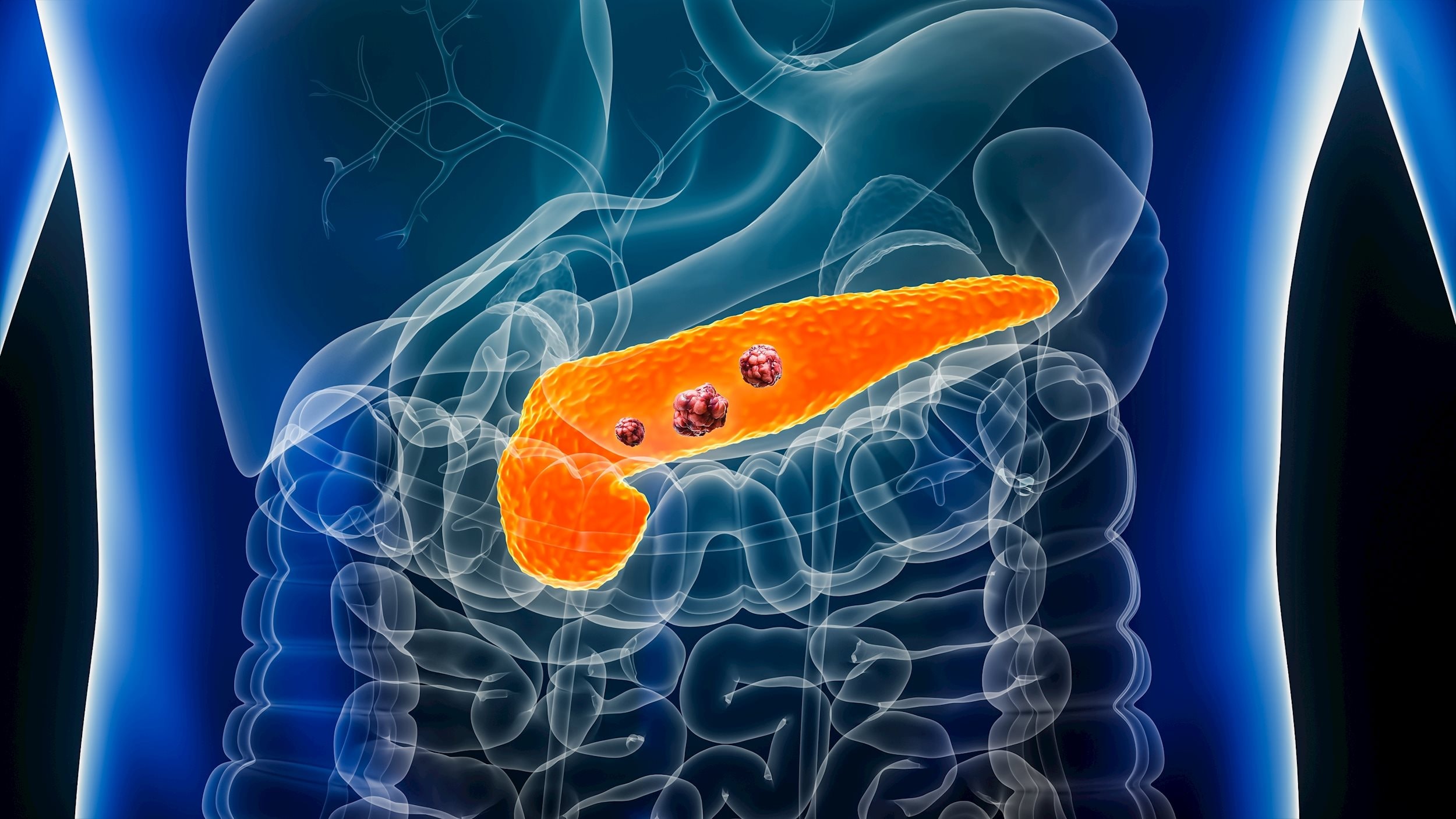 20230523-pancreatic_0.jpeg