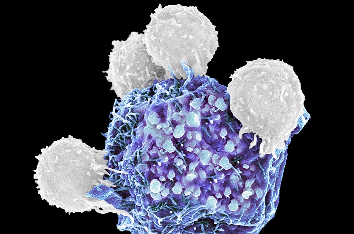 _20230416_nid_cancervaccine.jpeg