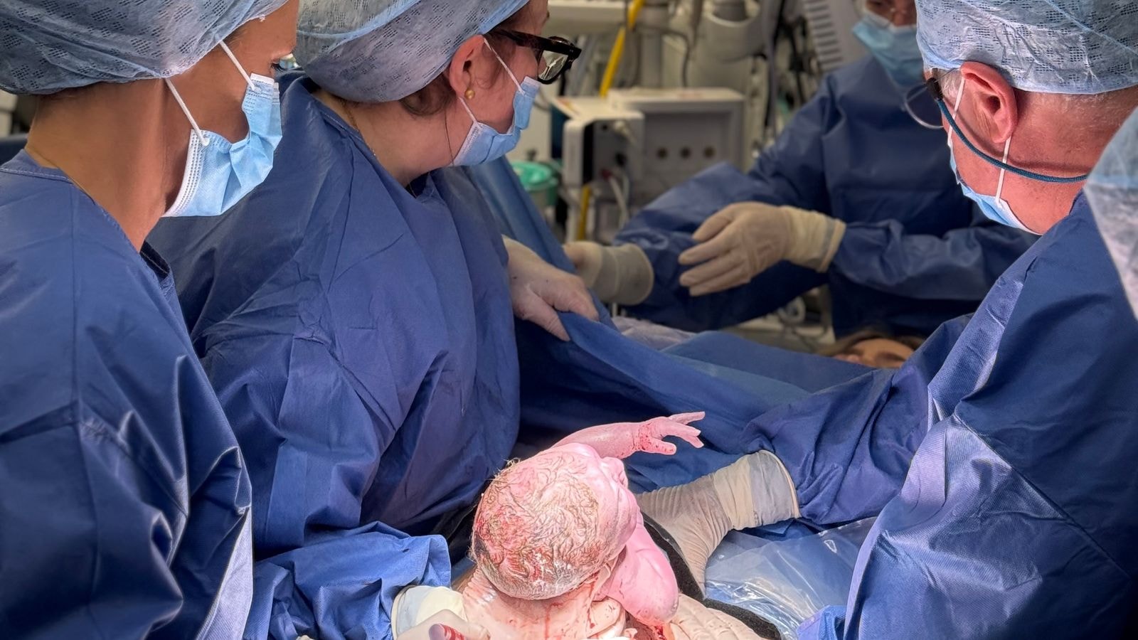 skynews-womb-transplant_7172703.jpg
