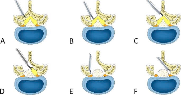 cột sống 2