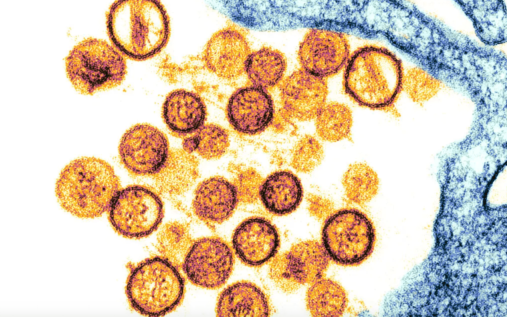 hantavirus.png