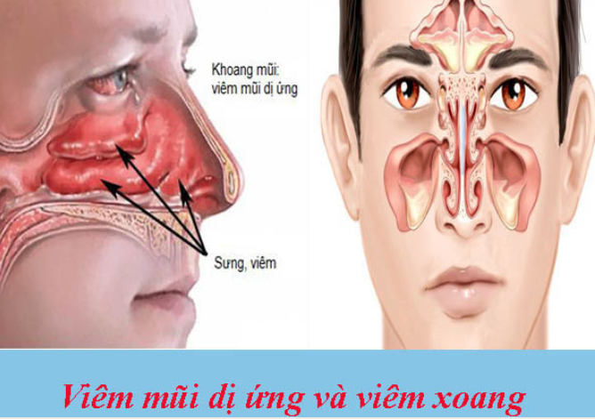 b9eefd1d-abea-4944-b55b-166aa5499895_mceu_50121742511781063230944.png