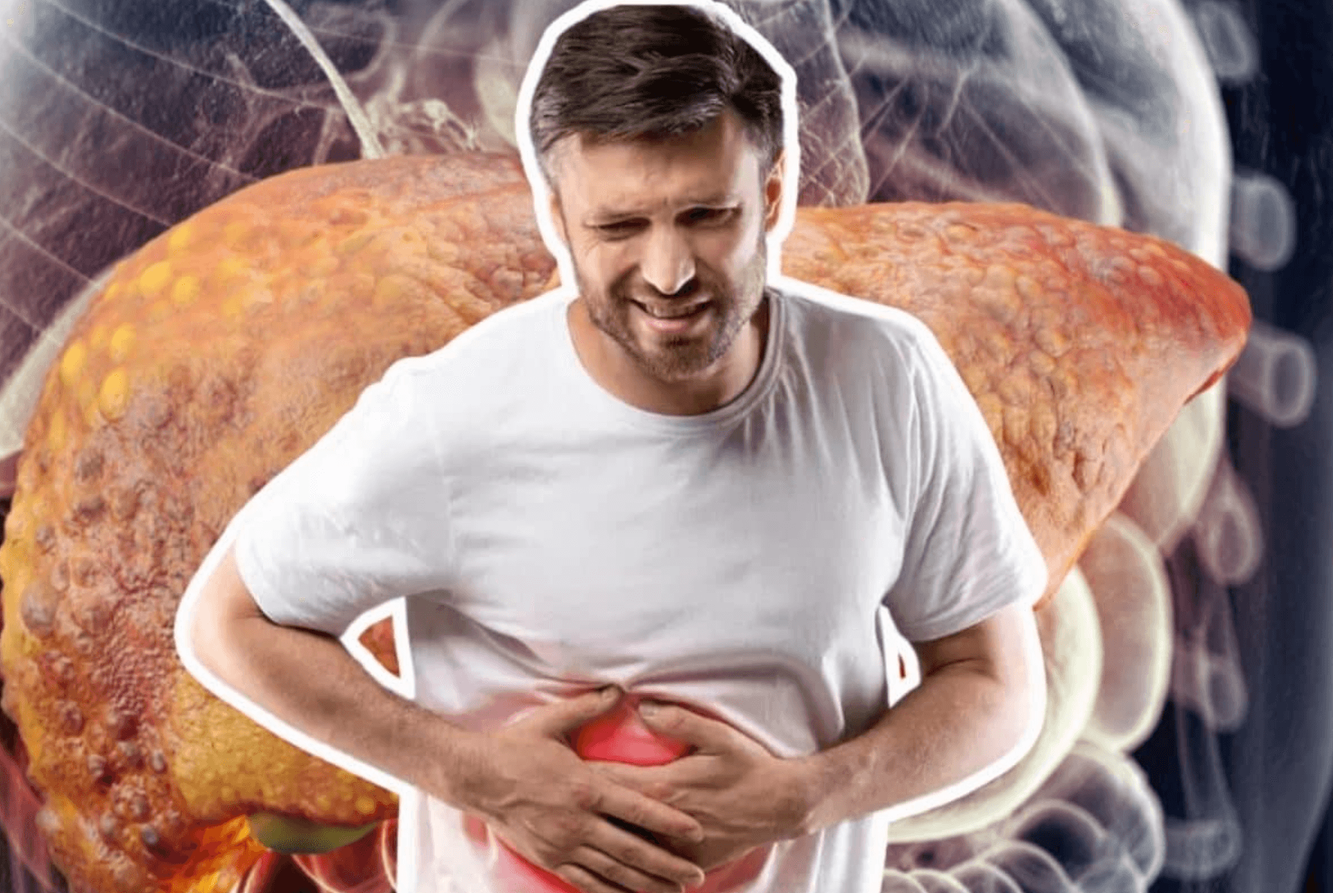 fatty liver 1