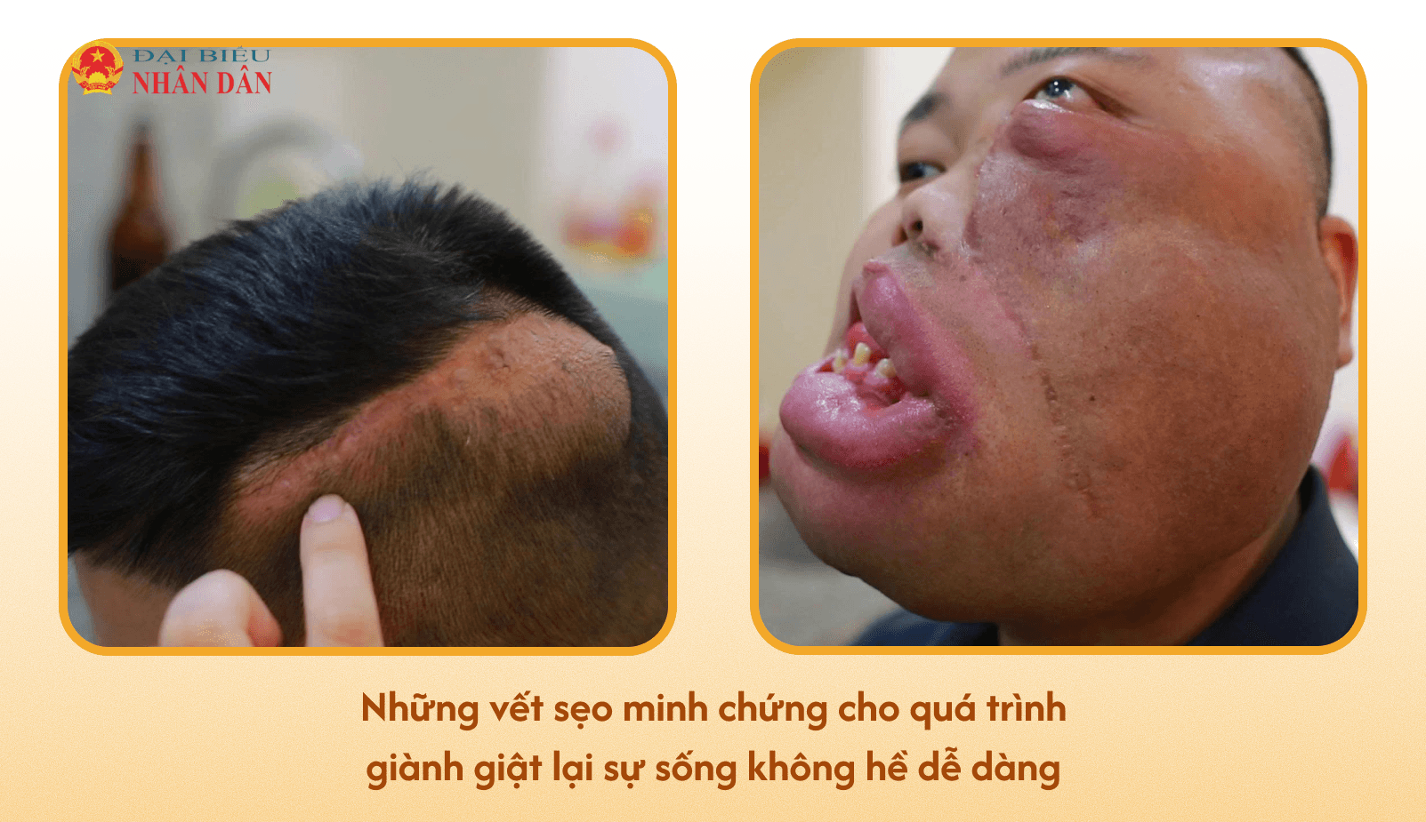 Khi số phận không dịu dàng, con người vẫn có thể sống thật đẹp