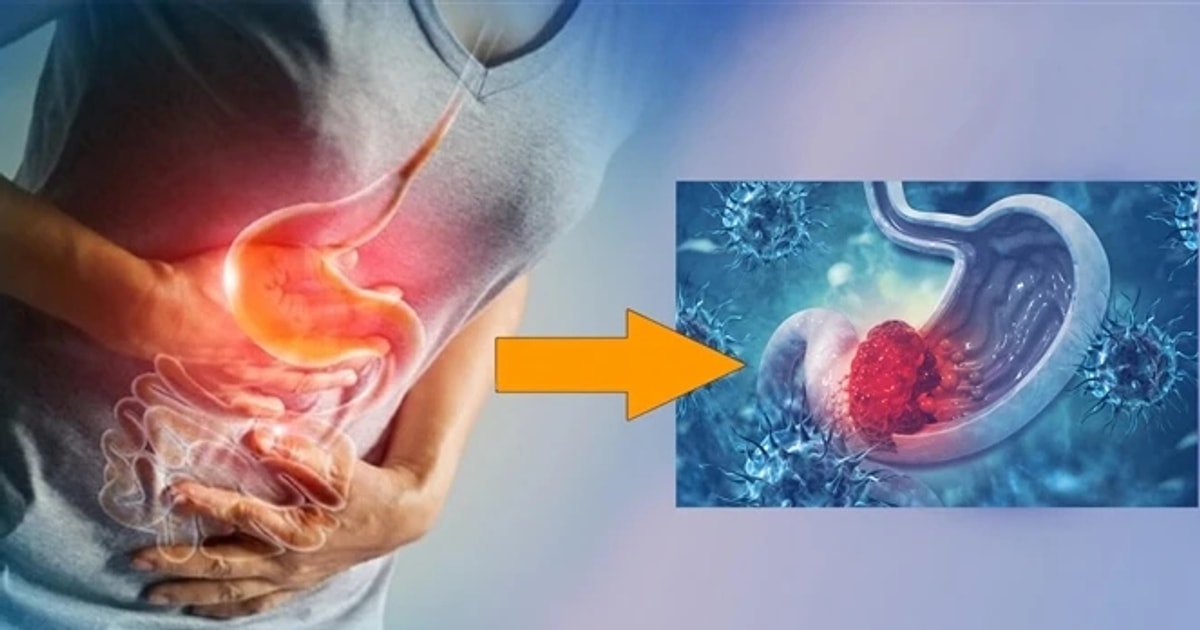 Tỷ lệ ung thư dạ dày ngày càng trẻ hoá, bác sĩ cảnh báo