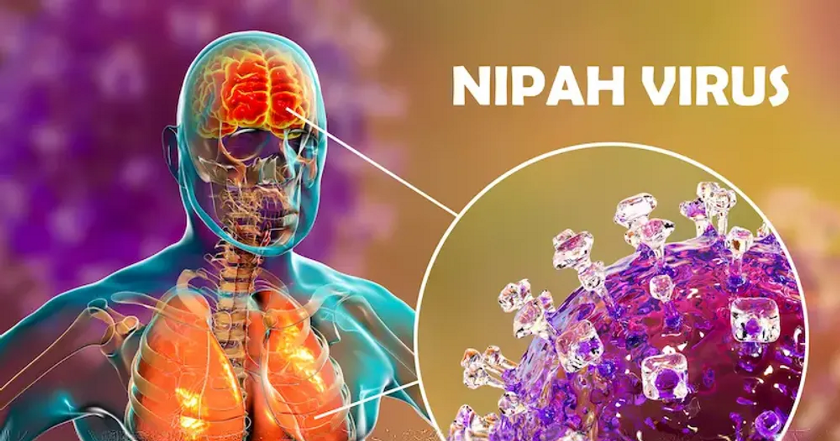 WHO n&oacute;i g&igrave; về virus Nipah?