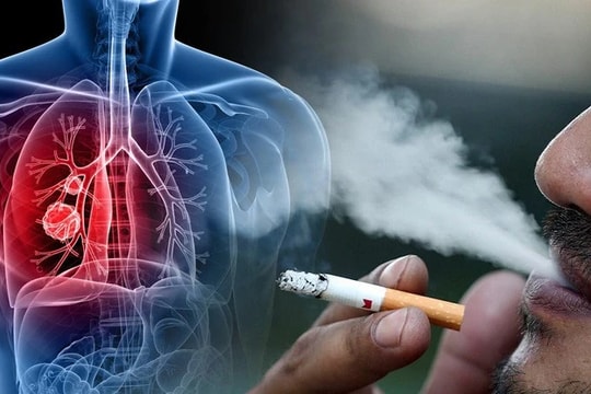 Tỷ lệ người dân được tư vấn và cai nghiện thuốc lá tăng cao