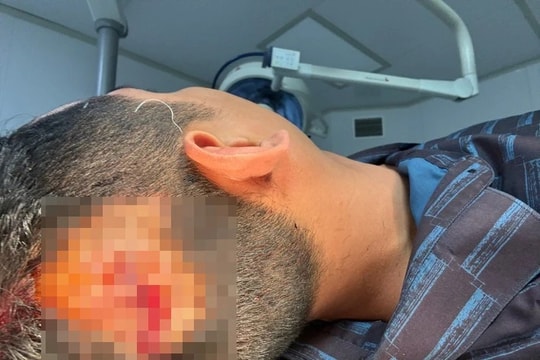 Vụ người dân bị đánh bất tỉnh khi đi ăn đêm: Công an quận Bắc Từ Liêm đã khởi tố vụ án