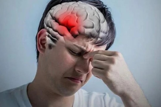 Đau đầu kéo dài, người đàn ông bất ngờ phát hiện phình mạch máu não