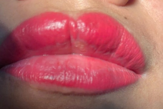 Xăm môi giá rẻ tại spa để đón Tết, người phụ nữ hốt hoảng "cầu cứu" bác sĩ