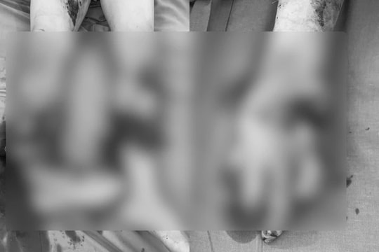 Bình ga mini bất ngờ phát nổ khiến người đàn ông phải cắt bỏ chân