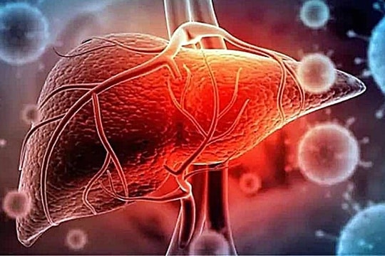 Suy gan cấp vì lạm dụng thuốc nam… tăng sinh lý