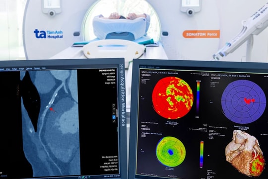 Siêu máy chụp CT phát hiện sớm đột quỵ, ung thư