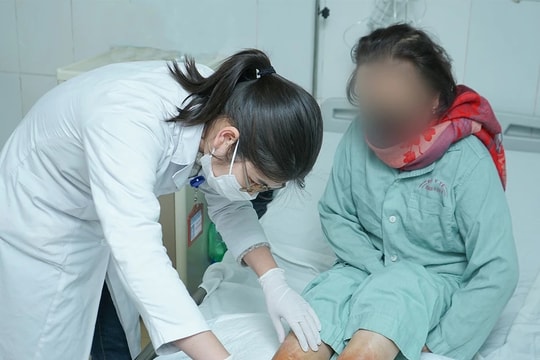 Bác sĩ cảnh báo không dùng bột lá ngâm rửa, đắp da: nguy cơ viêm da tiếp xúc dị ứng