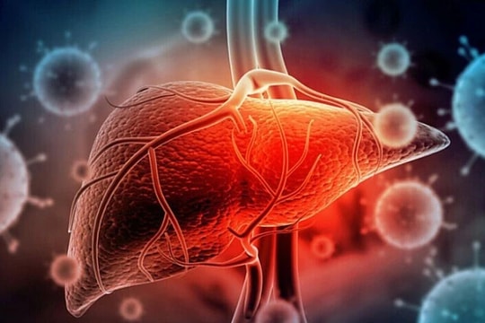 6 yếu tố gây ung thư gan 