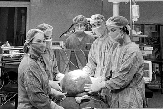 Uống thuốc nam không rõ nguồn gốc, người phụ nữ có khối u khổng lồ nặng 15 kg ở bụng 