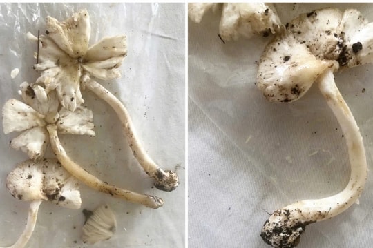 Bác sĩ khuyến cáo tình trạng suy gan, suy thận nguy hiểm vì ngộ độc nấm