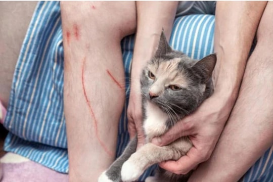 Người đàn ông tử vong sau khi bị mèo cào