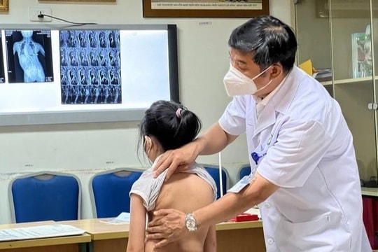 Bệnh viện Hữu nghị Việt Đức khám, tư vấn miễn phí bệnh lý gù vẹo cột sống ở trẻ em