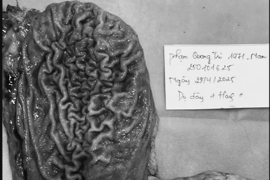 Bệnh viện K phẫu thuật thành công người bệnh mắc 2 loại ung thư