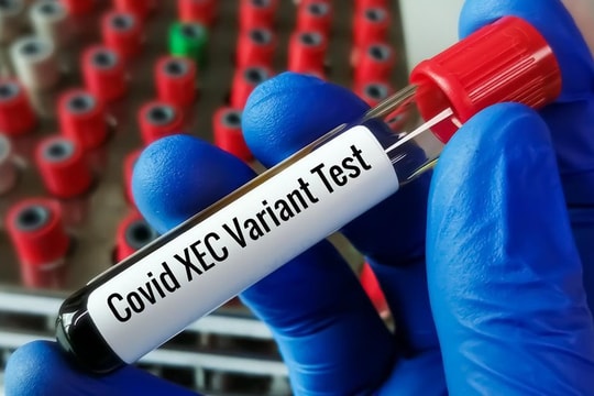 Covid-19 thuộc biến thể XEC lây nhanh gấp 7 lần cúm: Người dân cần chủ động phòng dịch