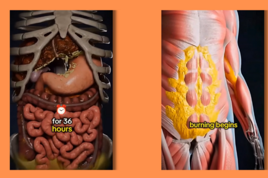 Nhịn ăn 36 giờ: Thử thách cực đoan hay liệu pháp thanh lọc kỳ diệu?