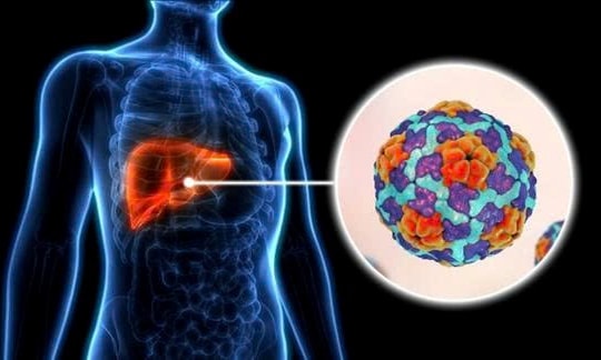 Viêm gan A âm thầm lây lan: Cách phòng, điều trị hiệu quả