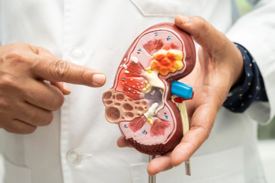 Suy thận trẻ hoá: Biểu hiện và cách phòng tránh