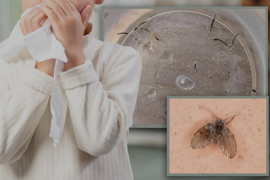 Bé gái nôn ra giòi sống suốt một tháng: Cảnh báo nguy cơ từ ngay trong nhà