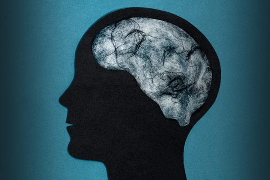 Đại dịch COVID-19 và di chứng ít ai ngờ: Lão hóa não ở cả người không nhiễm bệnh