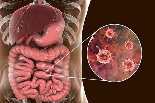 Bộ Y tế khuyến cáo phòng bệnh lỵ a-míp từ nguồn nước và thực phẩm