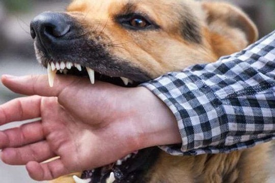 Cảnh báo nguồn lây nhiễm bệnh dại từ nuôi chó cảnh