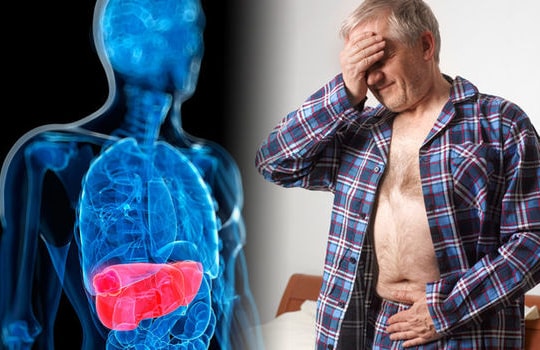 Béo phì, rượu bia, viêm gan: Bộ ba "sát thủ" đẩy ung thư gan tăng vọt