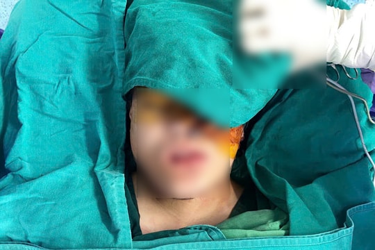 9 giờ phẫu thuật trả lại gương mặt cho bé gái H’Mông mang khối u khổng lồ