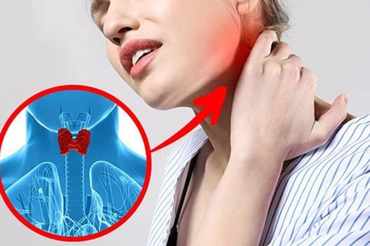 Các dấu hiệu cảnh báo bệnh tuyến giáp