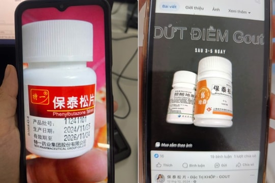 Bệnh viện Bạch Mai cảnh báo khẩn cấp về loại thuốc chống viêm Phenylbutazone đã bị cấm tại Việt Nam